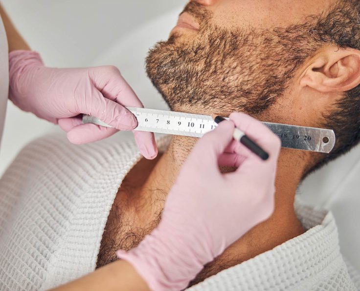 Close up of woman hands in sterile gloves placing ruler on male neck and drawing straight line with white pencil